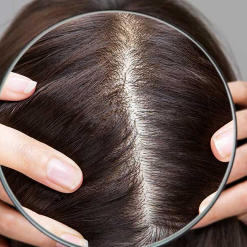 Scalp Treatment for Hair Loss Ampoule Kit